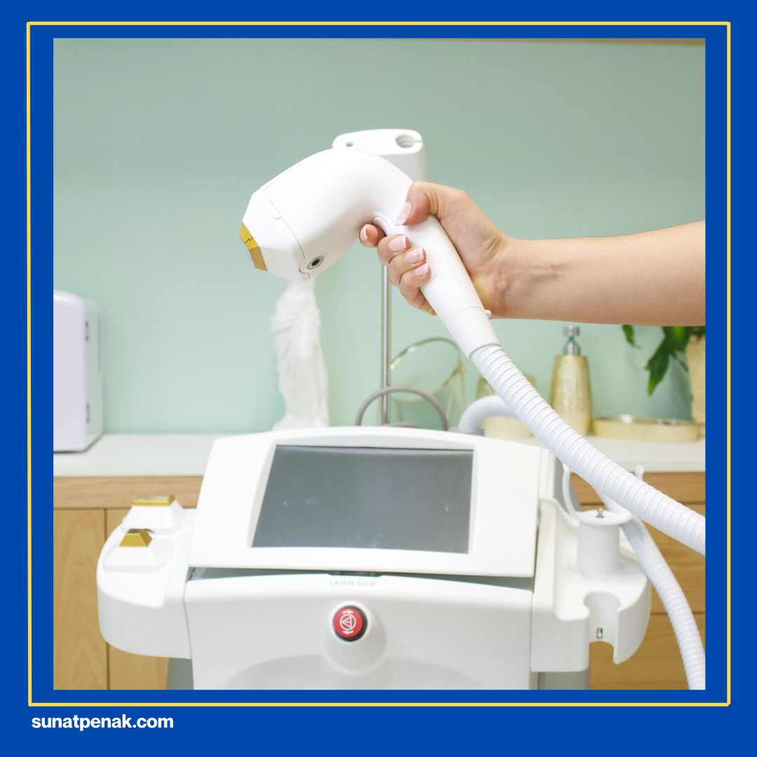 Metode Laser (Cauter).