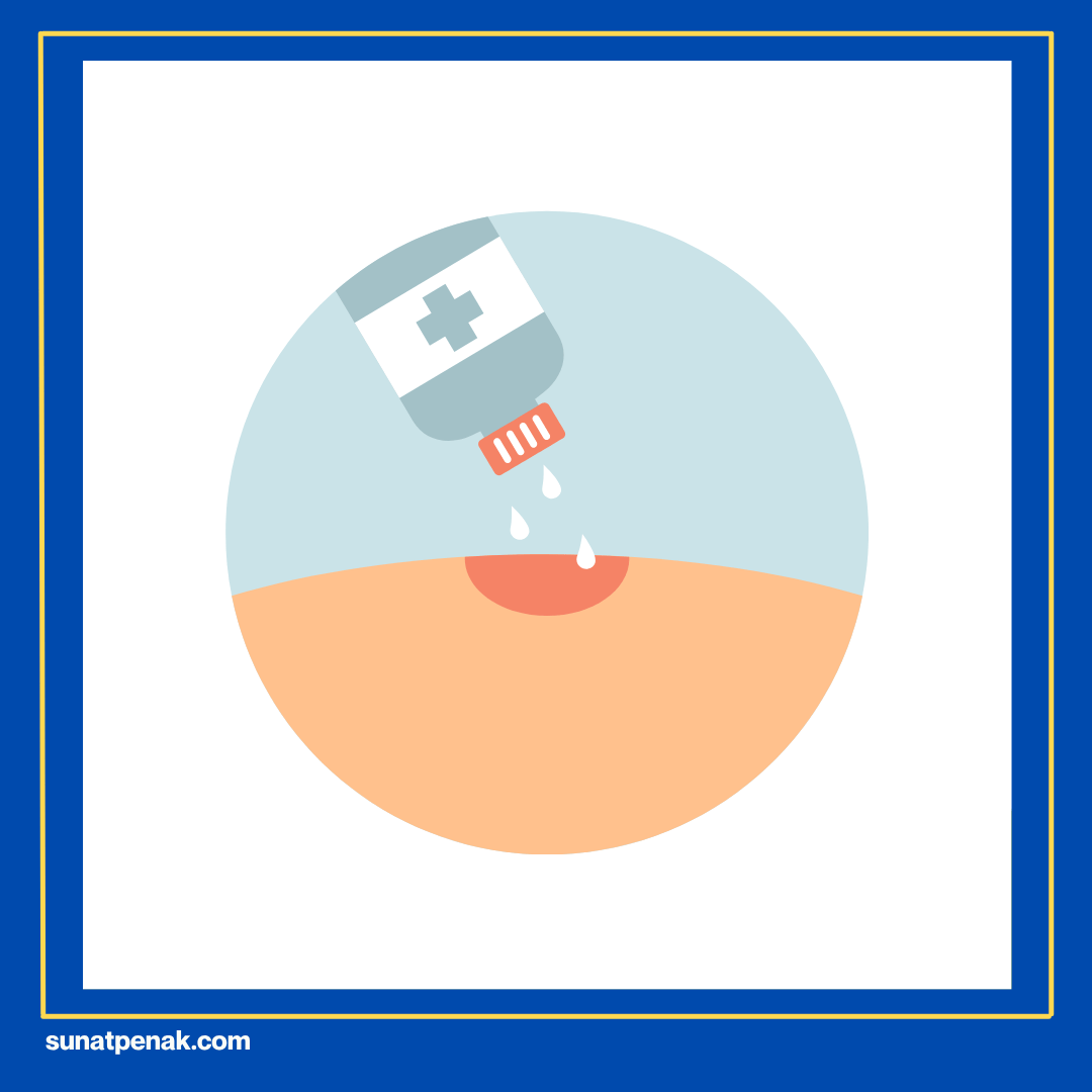 Menjaga Luka Tetap Lembap