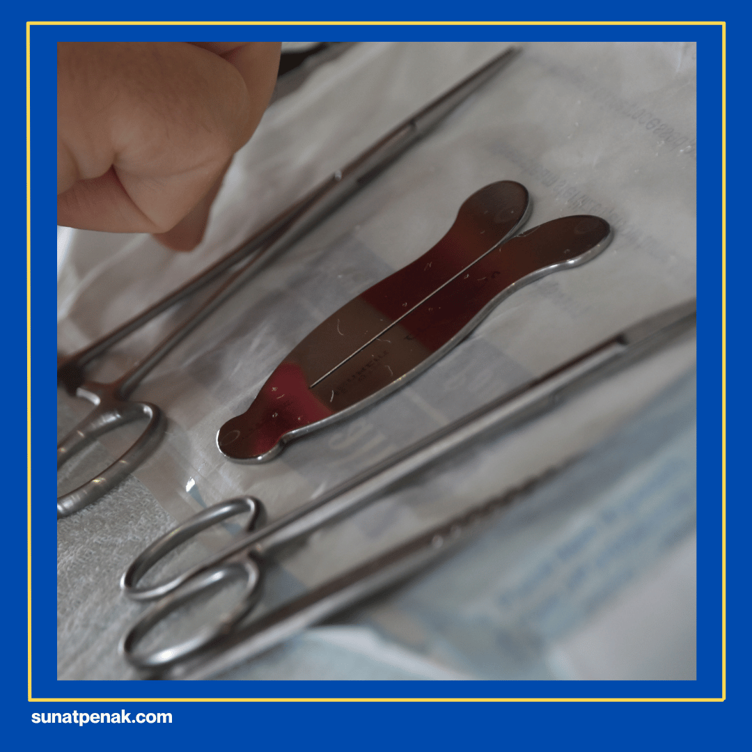 Teknik Sunat yang Kurang Tepat