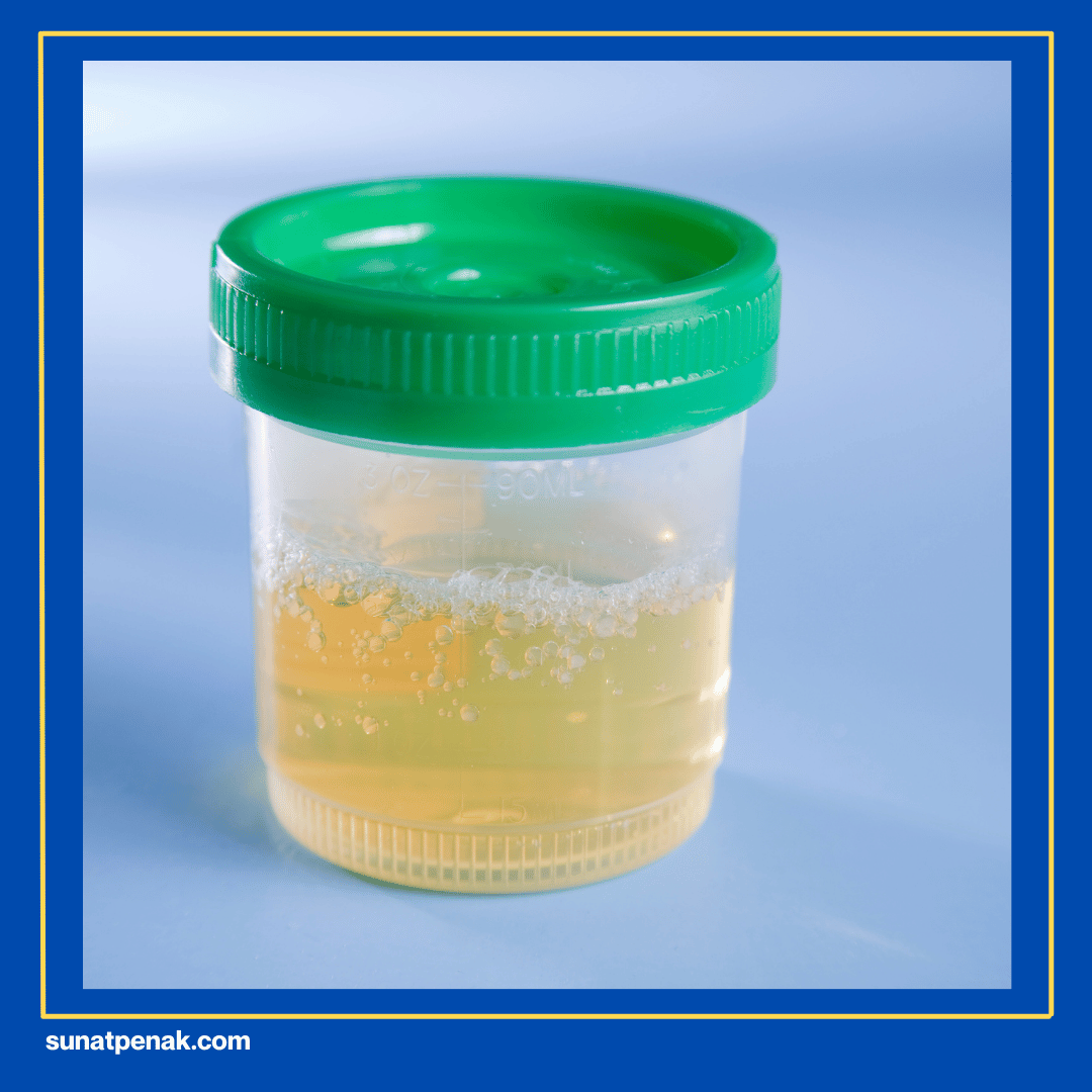 Busa Banyak dan Bertahan Lama