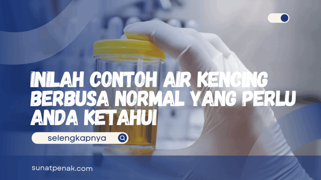 Contoh Air Kencing Berbusa Normal