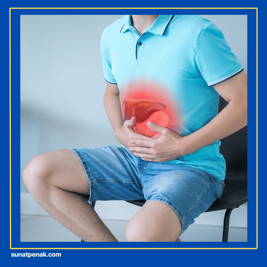 Hernia Inguinalis dan Kondisi Lain