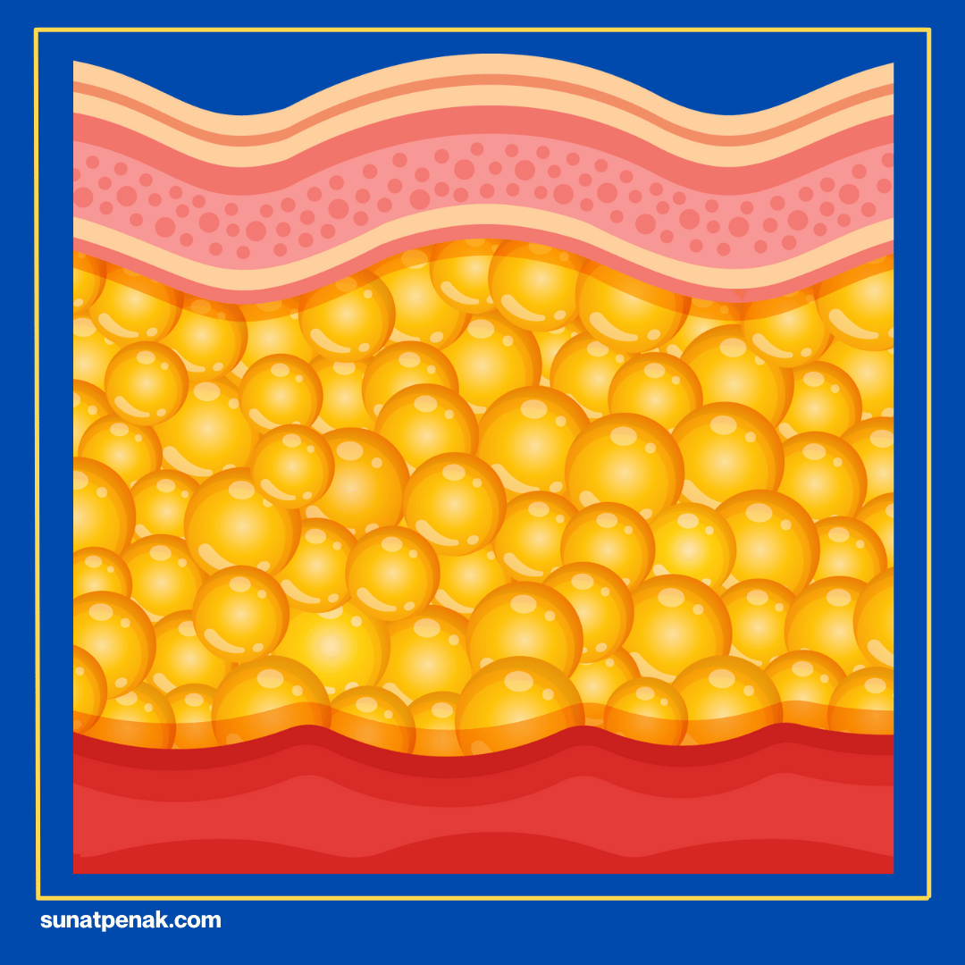 Penyebab Fimosis Fisiologis