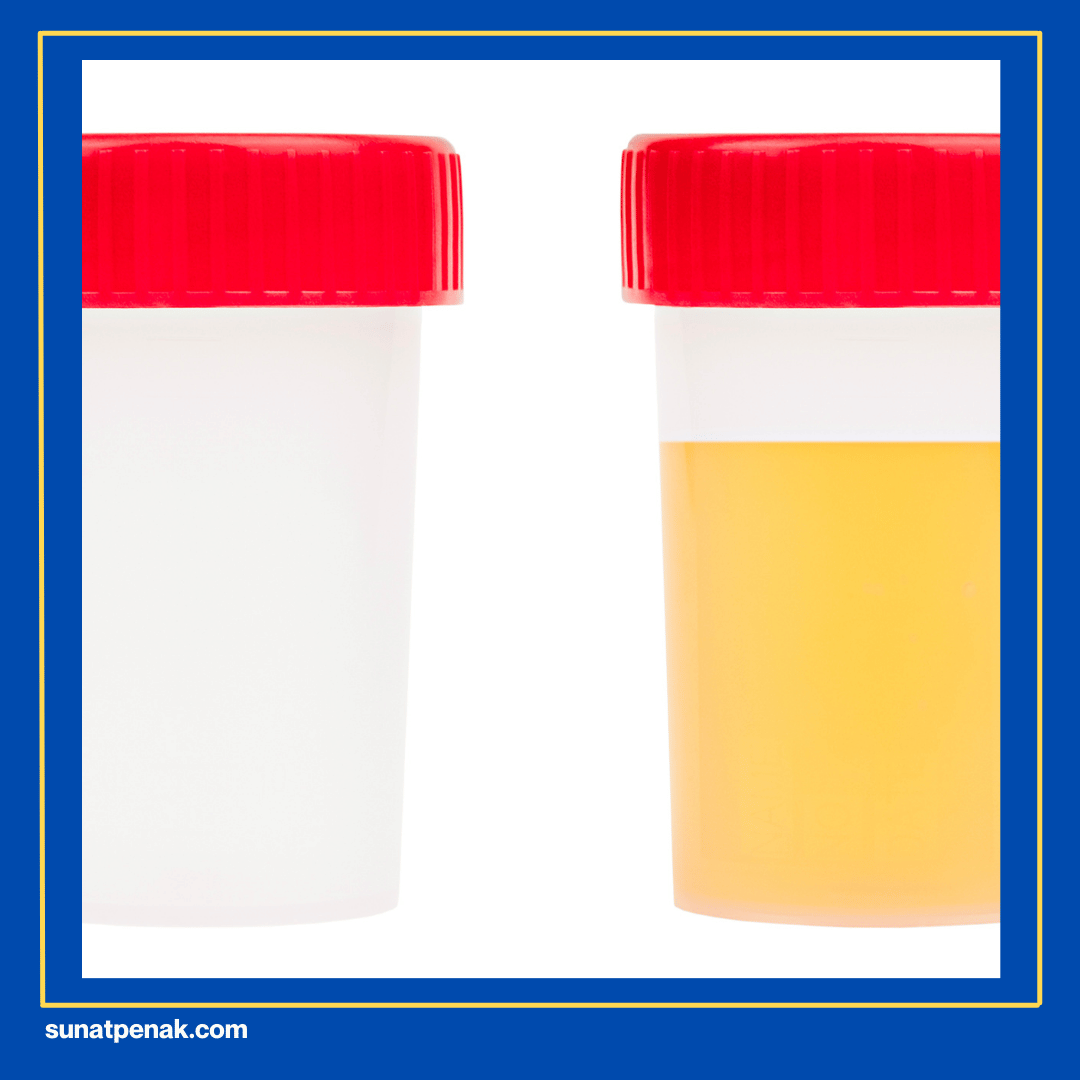 Perbedaan dari Ciri-Ciri