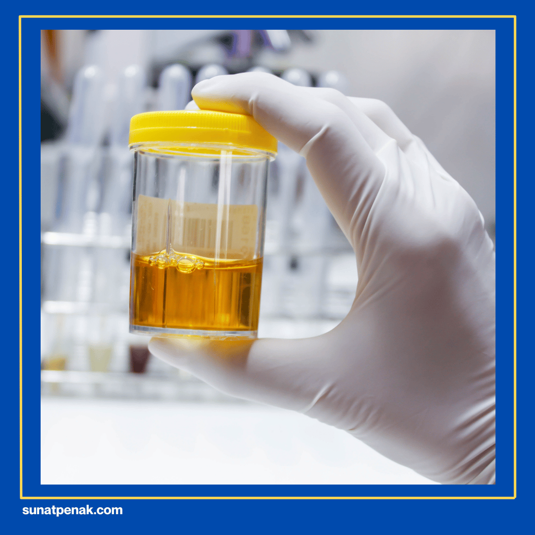 Urin yang Tidak Normal