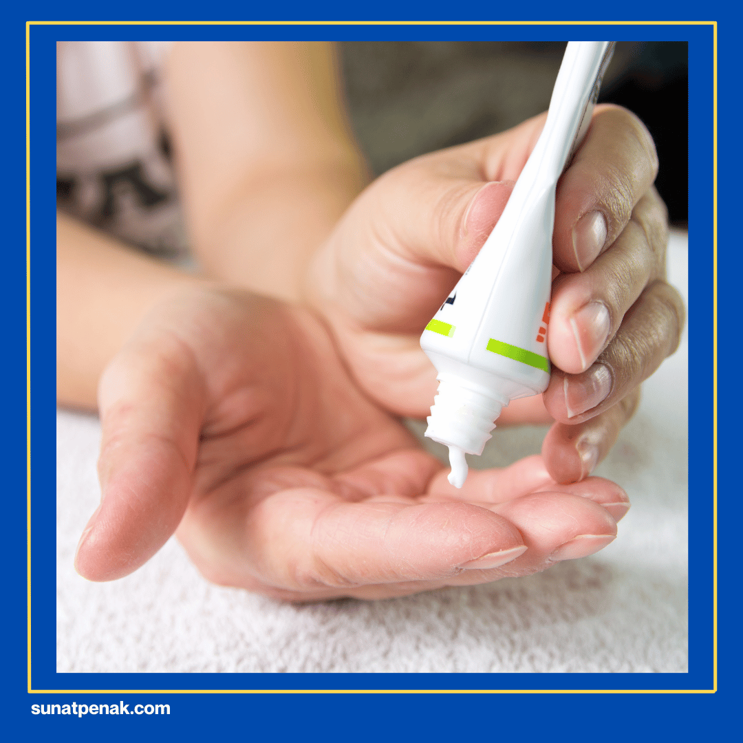 Gunakan Obat dan Salep yang Tepat