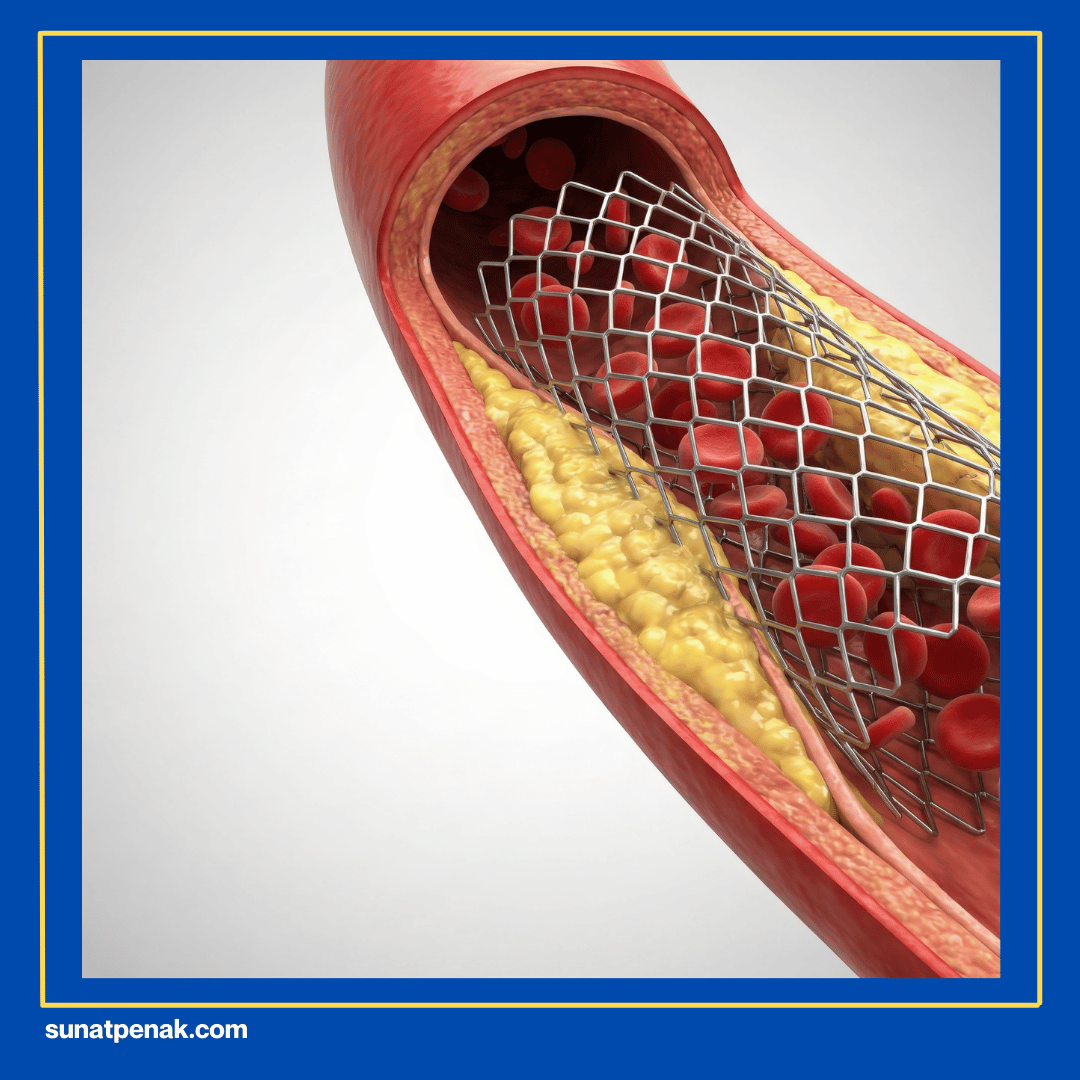 Penumpukan Smegma/Reaksi Alergi