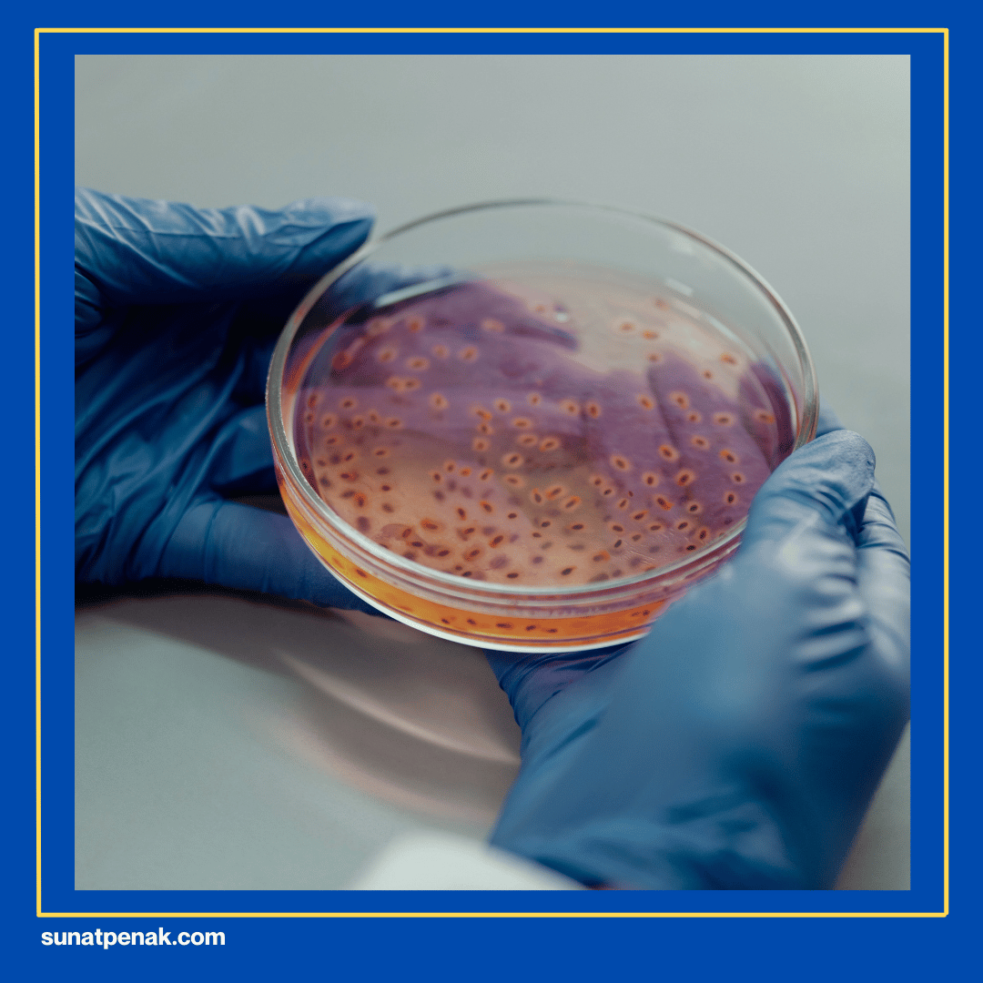 Mengatasi Faktor Penyebab ISK