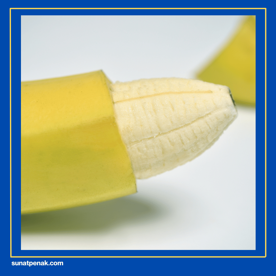 Teknologi Sunat Modern yang Aman