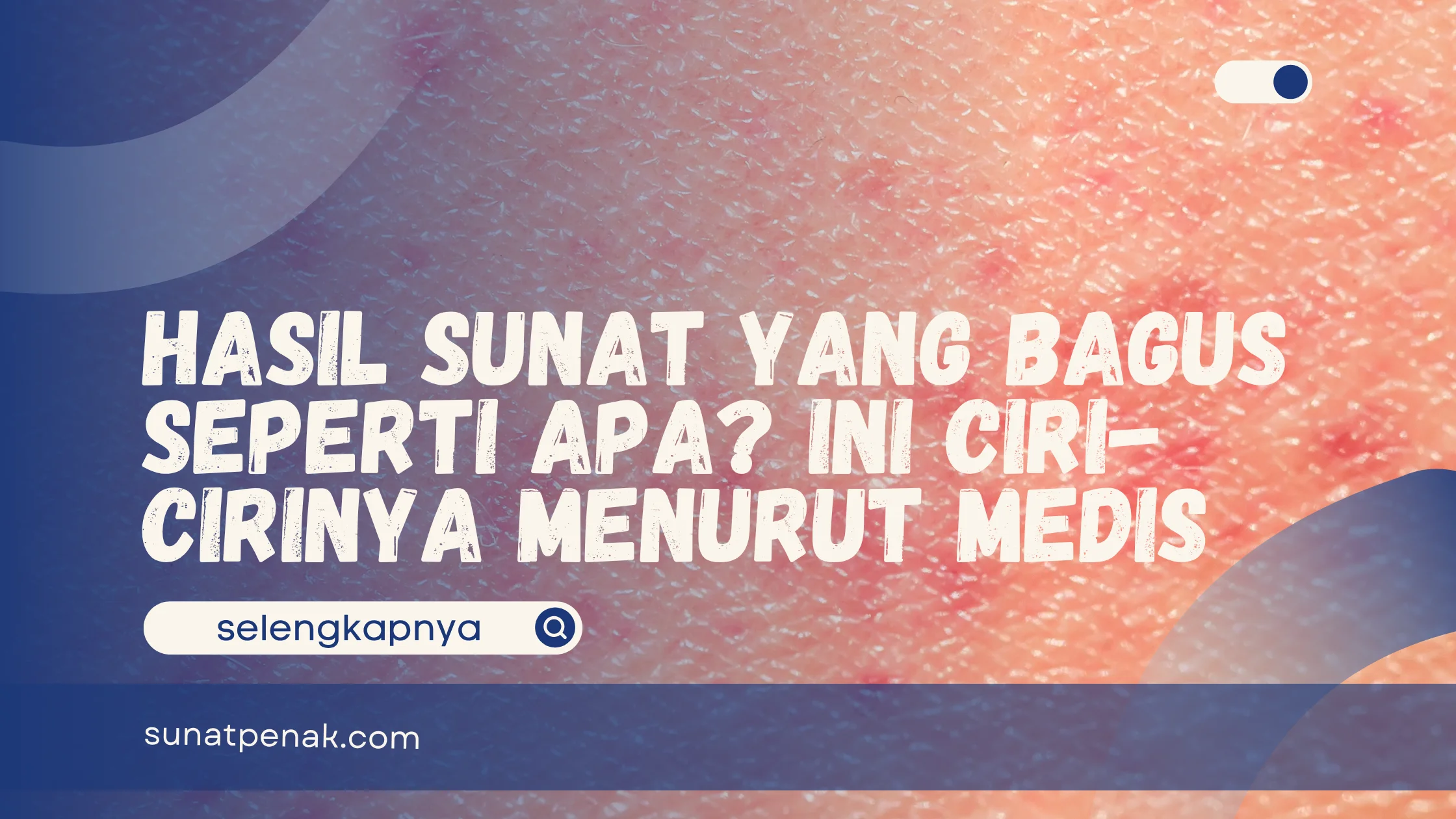 Hasil Sunat yang Bagus Seperti Apa