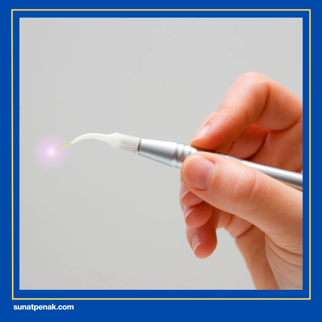 Tanpa Laser